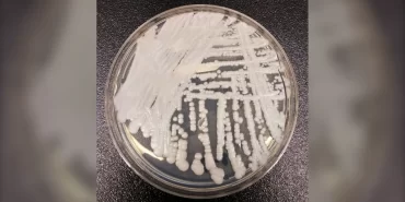 candida-auris