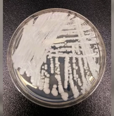 candida-auris