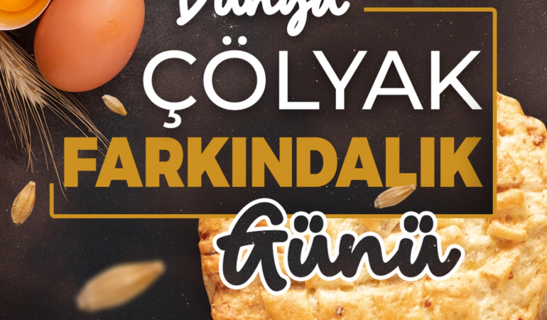 Başkan Büyükkılıç’ın İnsan ve Sağlık Odaklı Projesi Glütensiz Kafe Kayserililerin Gözdesi Oldu
